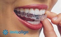 smileteq dental clinic יישור שיניים שקוף image
